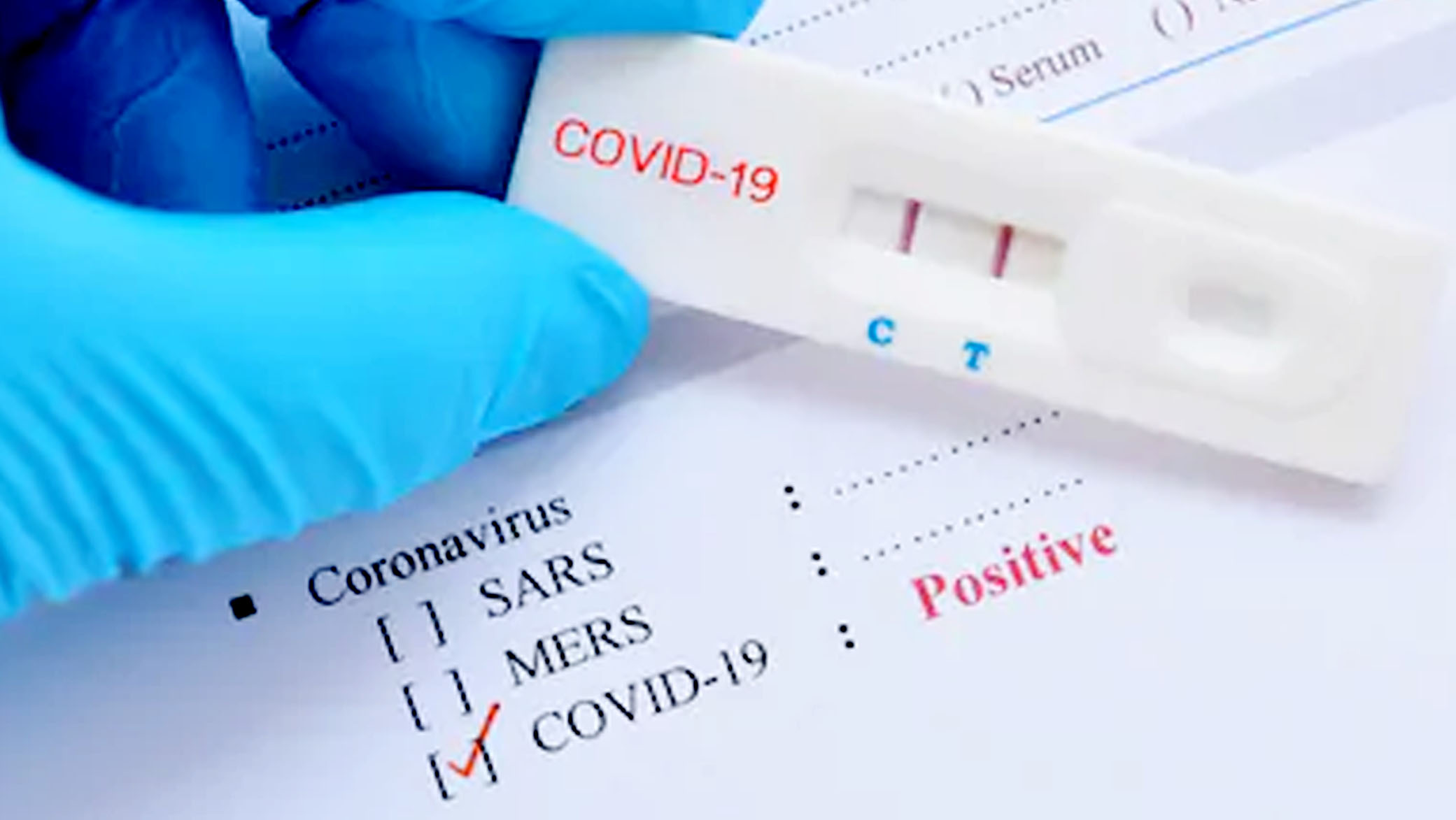 Tes Virus Corona, Dua Dari 1.179 Orang Positif Dikonfirmasi Oleh EFL